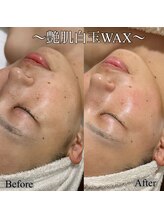 エレーナ(ELENA)/白玉WAX+炭酸パック