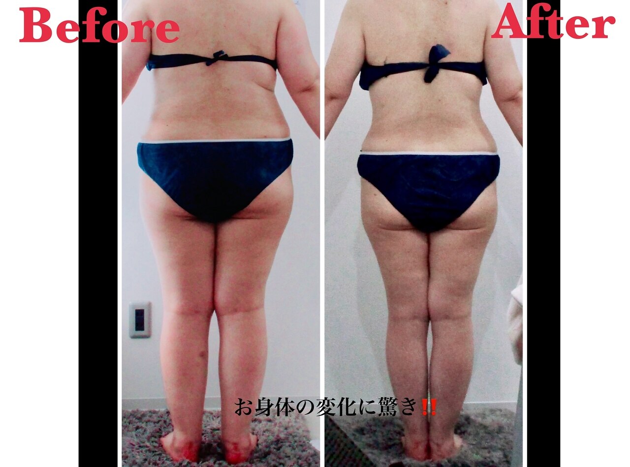 【本気で結果を出したい方必見！】全身脂肪ケアコース70分