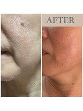 小顔専門サロン ラリューシュ(La ruche)/ほうれい線ケアもおまかせ