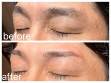 クラシックス(CLASSICS)/アイブロウbefore&after