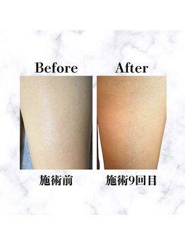 イルマーレ(Il Mare)/お客様Before&After