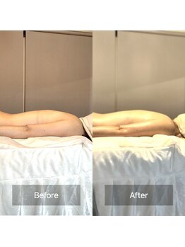 プリヤ(PRIYA)/ビフォーアフター