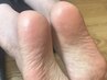 【角質ケア】滑らかかかと&お爪周りケア☆