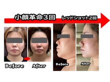 コンフィデンス 守口店(Confidence)の雰囲気（最速ダイエットの力です！）