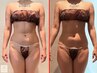 人気No3!インディバ超え痩身!ウィンバックくびれ上半身集中痩せ!むくみ解消