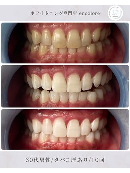 エンコロレ(encolore)の写真/【確実な効果を求める方へ】専用ジェルが使用可能だから叶う効果！清潔感のある印象に♪