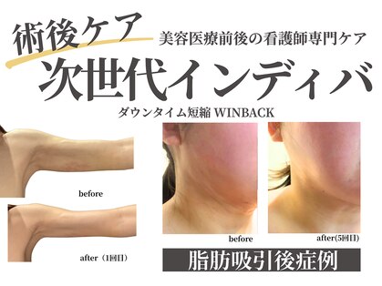 ノーブルノアール(Noble noir)の写真