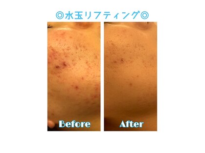 プリンセサガーデン(Princesa Garden)の写真