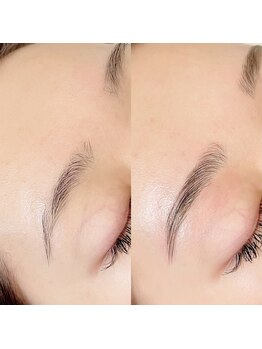 アイヴィー(EYEVY)/ハリウッドブロウリフト