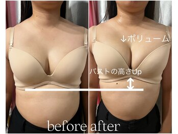 ビウラ(BIURA)/【20代】バストケアはやり方次第