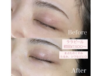 サニーラッシュ &nbsp;高蔵寺 志段味店(Sunny Lash)/大人気ララピール初回￥7,500