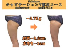 ビーバランス 本町店(美-Balance)/30代前半　月7部位コース