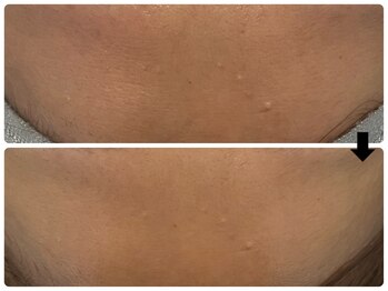 エフェクト 塚口店(effect)/before after