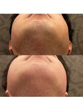 フェリーバ 流山店(FELIVA)/ここまで変われます！！