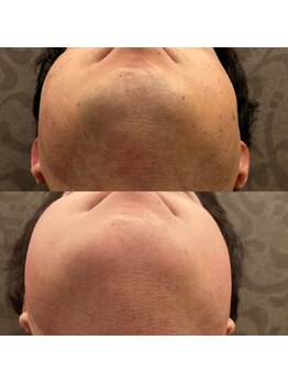 フェリーバ 流山店(FELIVA)/ここまで変われます!!