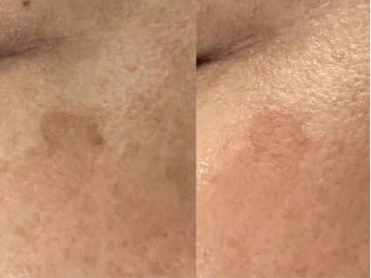 リシア(RECIA)の写真