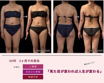 ヨサパーク ヴィータローザ 水戸赤塚店(YOSA PARK Vita Rosa)