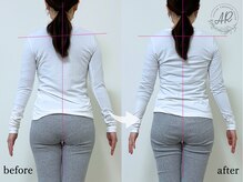 エーアール(AR)/【Before/After】