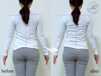 エーアール(AR)/【Before/After】