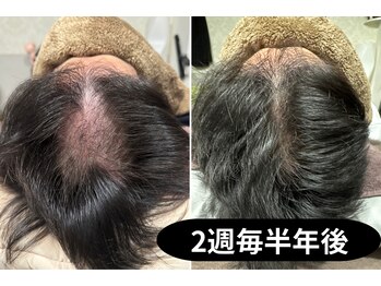 セントラル鍼灸院リラクシー(Re:laxy)の写真/四半世紀以上の経験と知識でお客様一人一人の体質・原因を個別解析！マンツーマンだから相談しやすいのも◎