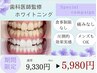 【5日間限定/先着5名】輝く白い歯♪ホワイトニング★通常¥9,330→¥5,980