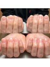 マルヤマサロン(MARUYAMA SALON)/自爪育成ネイルケア