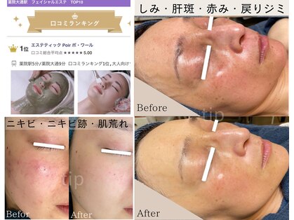 ポ ワール(Poir)の写真