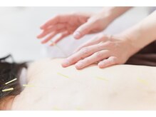 ハリシエール(Hariciere)の雰囲気（当院の鍼はお顔とお身体のセットがマスト！全身改善いたします！）
