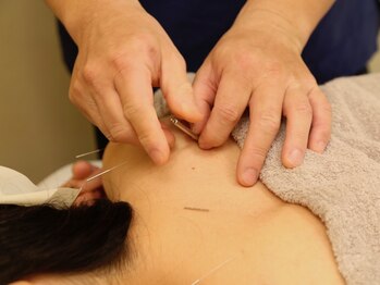 寝屋川かわい鍼灸整骨院/肩こり解消に!