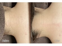 アネル うるま店(anel)/