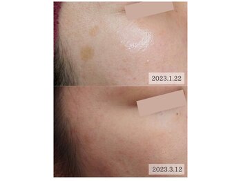 ビジュツ(BIJYUTSU)/