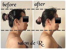 お悩みに繋がる原因を究明し立て直す◎繰り返さないブレない美軸