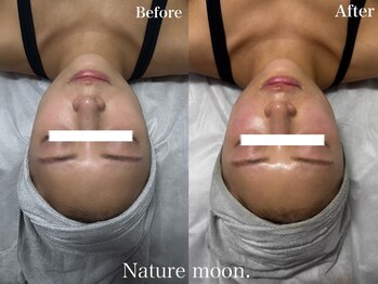 ナチュールムーン(Nature moon.)/ピーリング