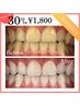 【40分は長いかも…というあなたに♪】お試し30分照射¥1,800【隙間時間で☆】