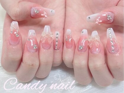 キャンディーネイル(candy nail)の写真