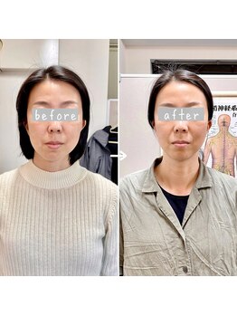 横浜DRT矯正院/小顔・美顔矯正