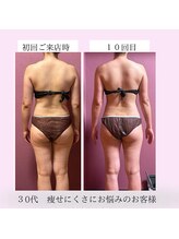 ビマリア(美-MARIA)/美-BODY痩身リンパ