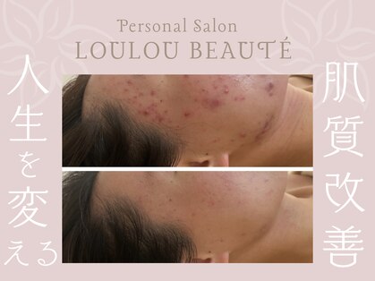 ルルボーテ(Loulou Beaute)の写真
