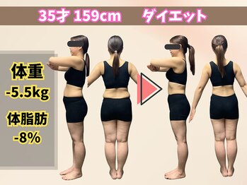 ほんじょう整骨院 美容整体/北九州/八幡西区/ダイエット