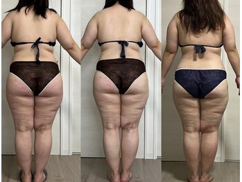 ヨルエステ(yoru aesthe)/【痩身・リンパドレナージュ】