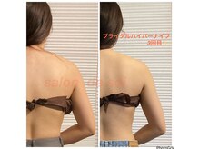 結果の出せる【ハイパーナイフ&パワーツリー】ブライダルにも◎