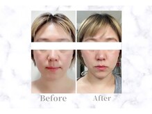 ふじこのきもち/3回目の変化