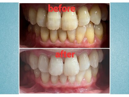 リュクネイル 拝島店(RyukuNail)の写真