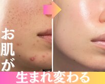 ラピュール(RaPur)