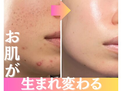 ラピュール(RaPur)の写真