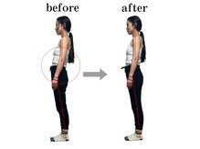 オステオデイジー(OsteoDaisy)