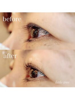 リトルツリー(little tree)/ラッシュリフト