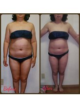 ダイエットルーム リ ボーヌ(Re Bornu)/・50代　全身メディセル16回