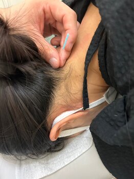 北島坂口鍼灸整骨院/自律神経の乱れが気になる方へ！