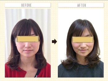 なぎ整体院/小顔矯正ビフォーアフター